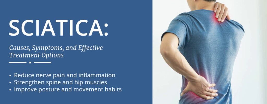 Sciatica: Causes, Symptoms, and Effective Treatment Options